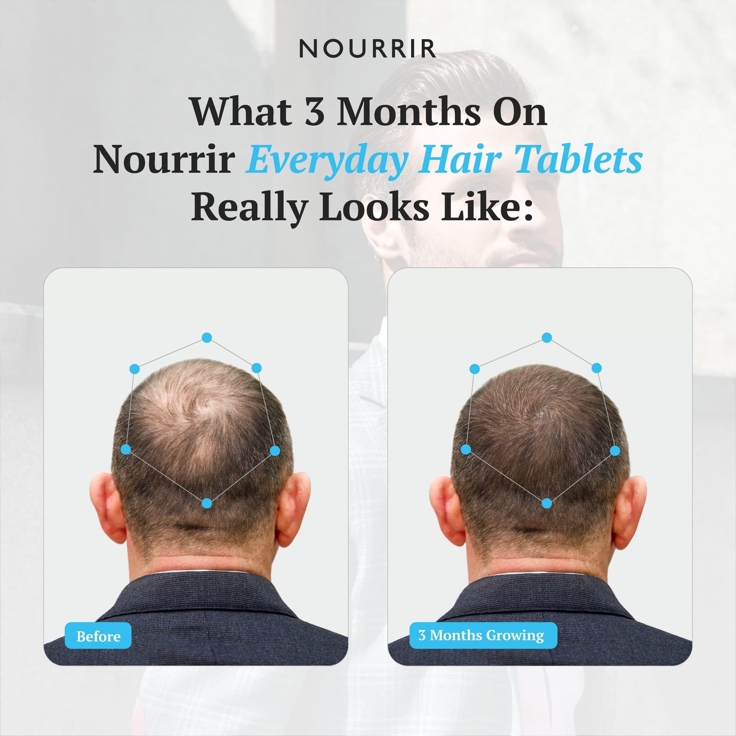 NOURRIR Men's Hair Growth Tablets - Biotin, DHT Blockers, Vitamins - Promotes Thick Hair, Balances Hormones 24 Count (Pack of 1) White