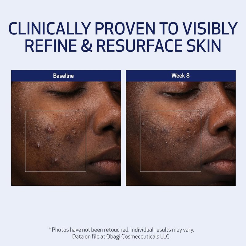 Obagi Medical Retinol + PHA Night Cream - Overnight Anti-Aging Formula for Smoother Skin | 1.7 Oz