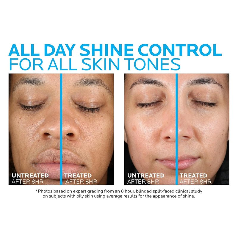 La Roche-Posay Acne Skin Care Set - Toleriane Moisturizer & Effaclar Gel Cleanser | 75ml & 100ml