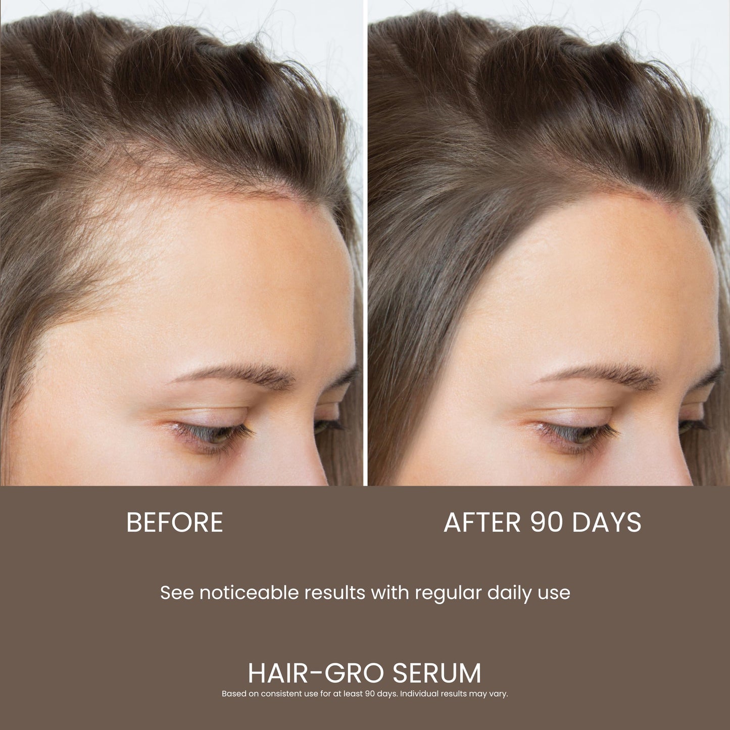 Hair Growth Serum for Women - Scalp Treatment for Hair Loss & Thinning Hair - Caffeine Peptide Regrowth Serum - Hair Thickening Serum - Natural Strengthening