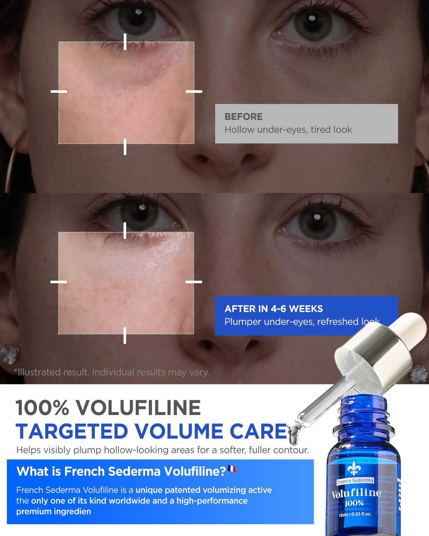 100% Volufiline Serum Skincare – Advanced Firming & Lifting Facial Ampoule from France Sederma, Intense Hydration & Skin Rejuvenation for Youthful, Perfect for Layering & DIY