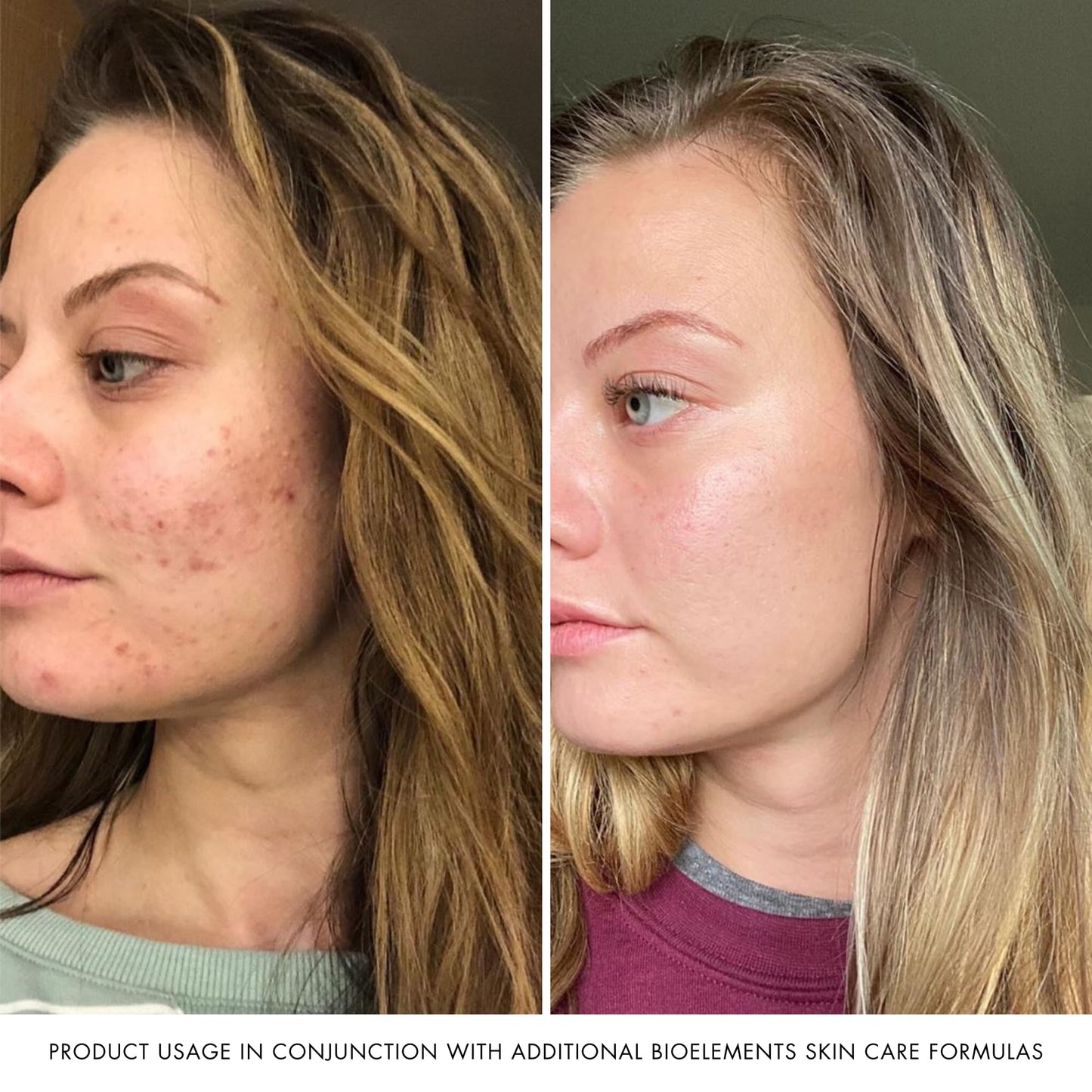 Bioelements RayDefense - 4 fl oz - Hydrating Broad-Spectrum SPF 30 Sunscreen & Moisturizer for All Skin Types - Vegan, Gluten Free - Never Tested on Animals