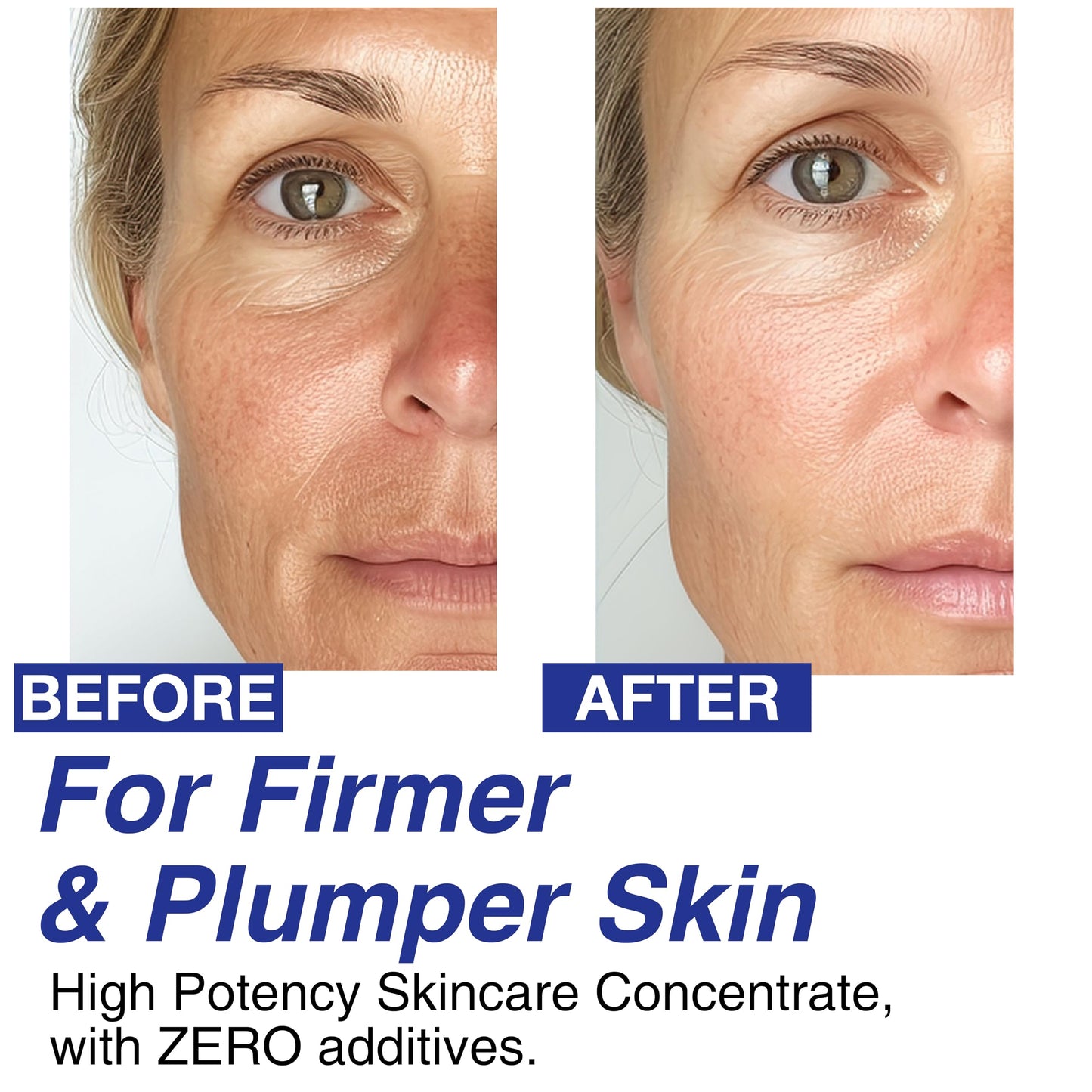 Volufiline 100% Concentrate Firming Serum for Sagging Skin – Face Tightening, Jawline & V-Line Contour Booster, Anti-Wrinkle Collagen Enhancer | Fast-Absorbing Mix-in Korean Skincare