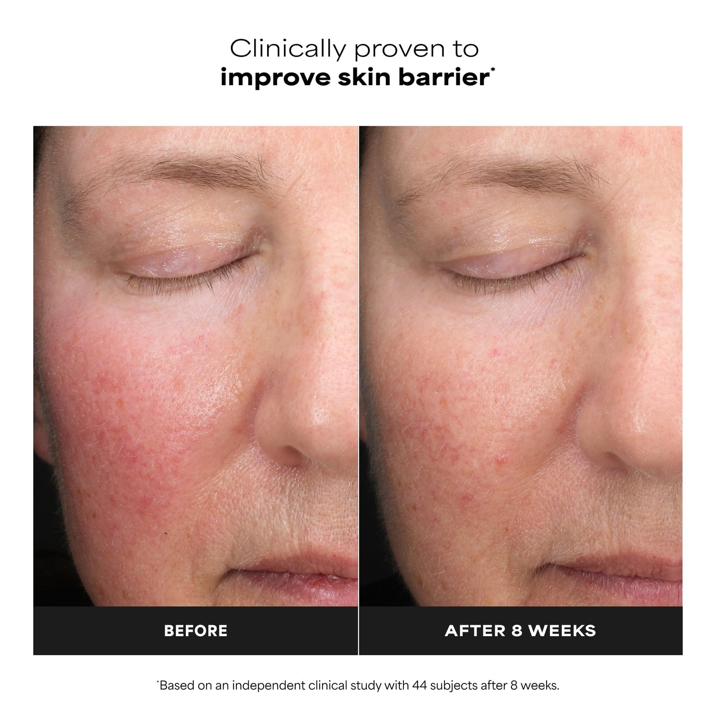 Paula's Choice 6% Mandelic + 2% Lactic Acid Liquid Exfoliant