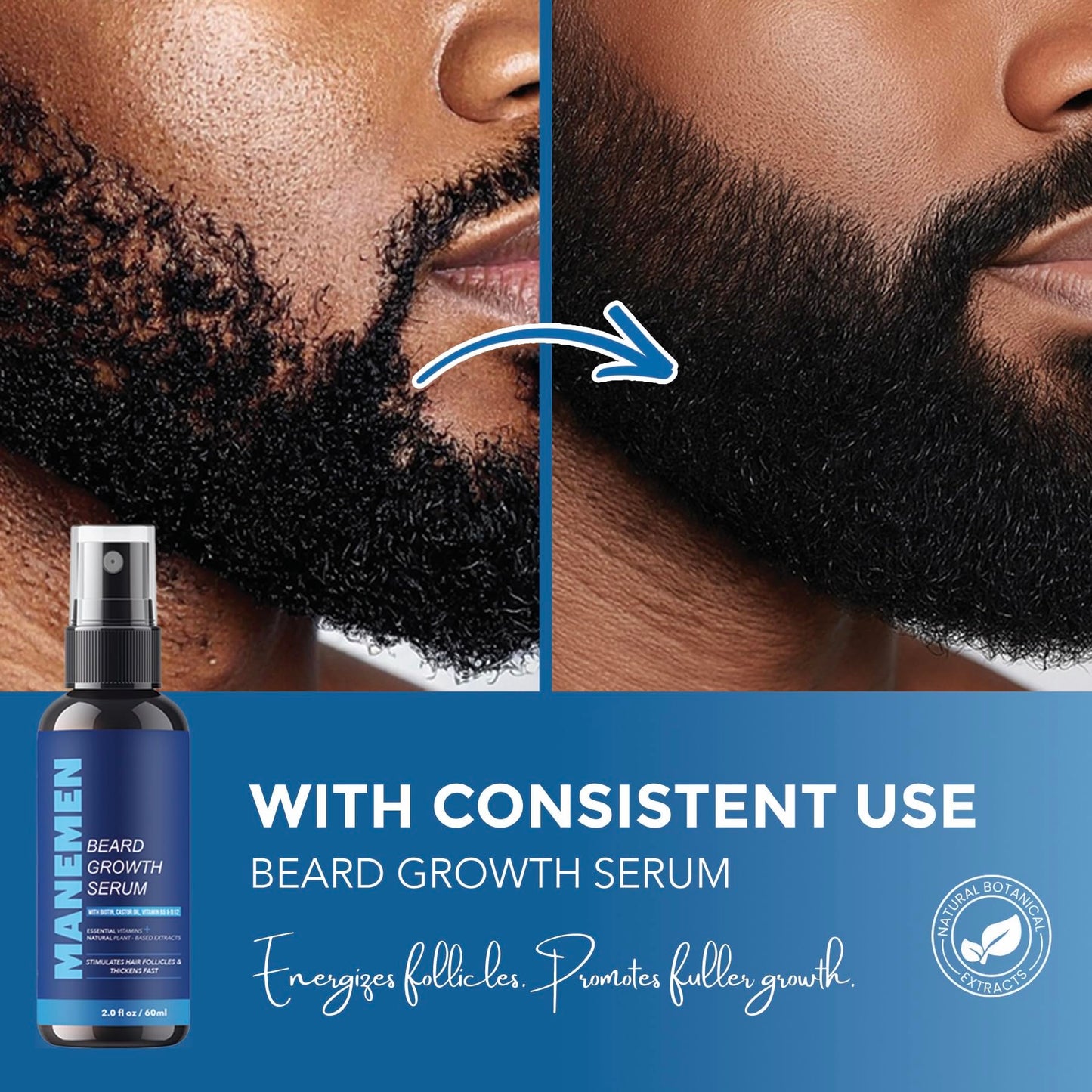 Manemen Beard Growth Serum Spray- Biotin, Castor Oil, Vitamin B5 & B12 - Natural Hair Regrowth Beard Oil Formula for Thicker, Fuller, Stronger Beard - Stimulates Hair Follicles & Supports Fast Growth