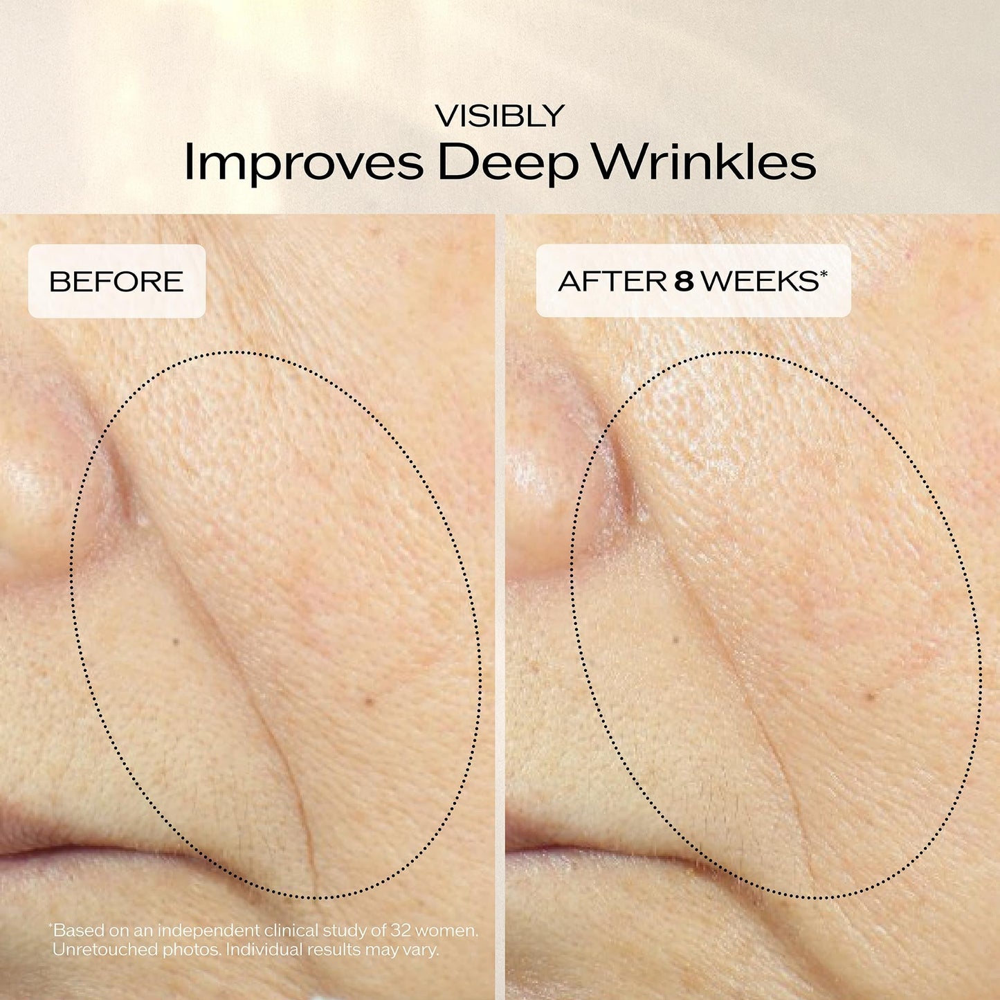 Shiseido Vital Perfection Uplifting and Firming Advanced Cream - 50 mL - Multi-Benefit Face Cream - Visibly Lifts & Firms