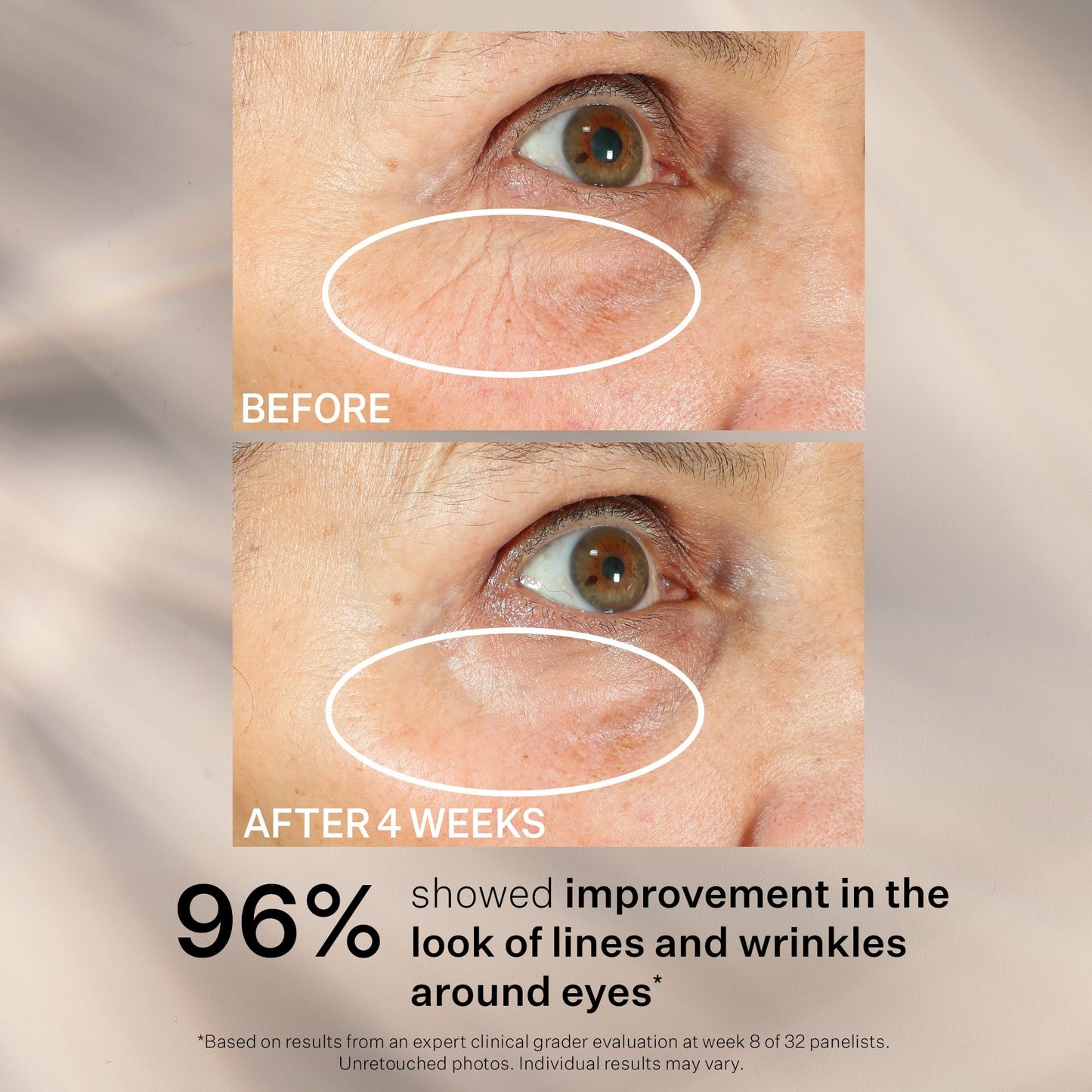 StriVectin Tighten and Lift Peptight 360 Degree Eye Serum with Tightening and Brightening Peptides for Wrinkles, Under Eye Bags and Puffiness, 1 fl. Oz