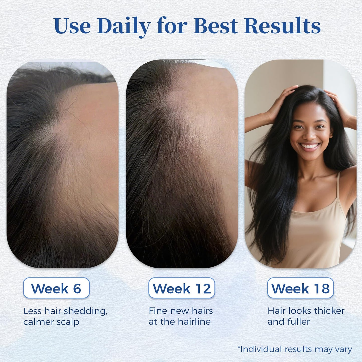 Gluvelessia Hair Growth Serum Roll On with Rosemary，Helps Support Thicker, Fuller Hair Appearance，Clean, Non-Greasy Hair Loss Support for Men & Women，Rosemary，0.84 Fl Oz (Pack of 1)