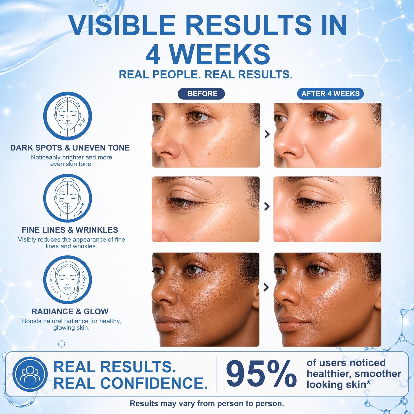 Anti-Aging Face Serum - Brightening Vitamin C Face Serum, Illuminating Formula for Improving Appearance of Dark Spots, Fine Lines & Wrinkles - Niacinamide Serum, Skin Care, All Skin Types 30 ml