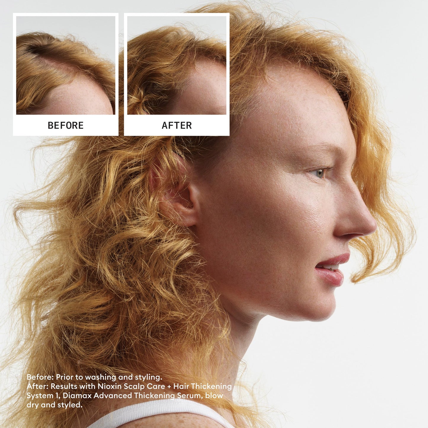 Nioxin Scalp + Hair Thickening System 1 Leave on Treatment | For Natural or Untreated Hair with Light Thinning | 6.8 Fl oz.