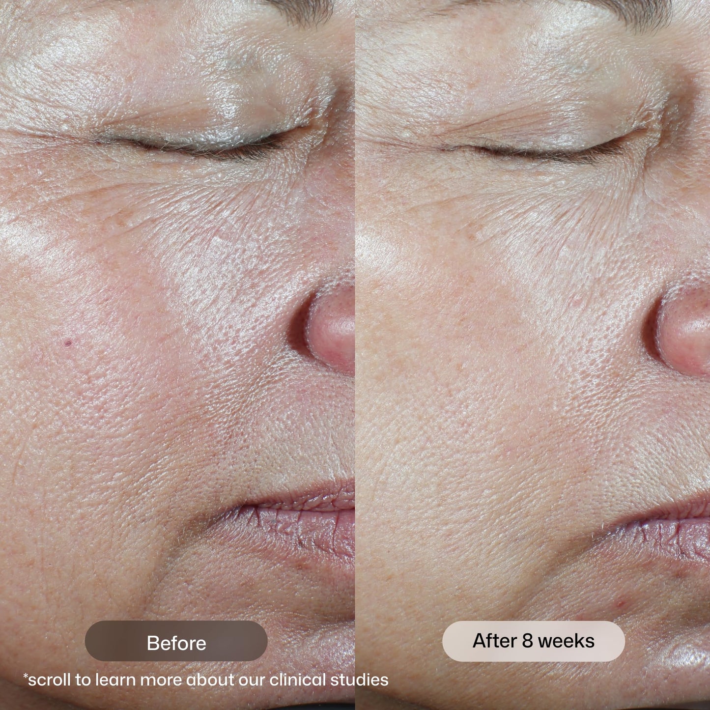 Revision Skincare C+ Correcting Complex 30%®, Anti Aging Antioxidant Blend with Vitamin C, Supports Healthy Skin, 0.5 fl oz