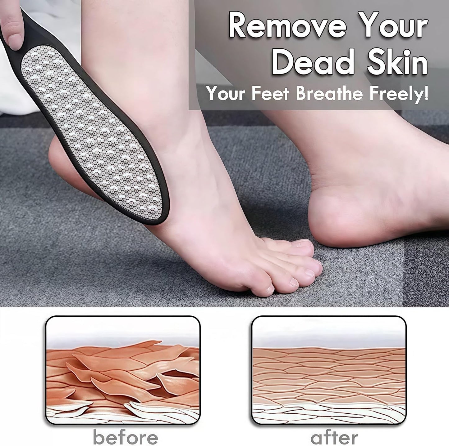 3 in 1 Foot File Callus Remover - Durable Double-Sided Stainless Heel Scraper for Cracked Heels | Pedicure Tool