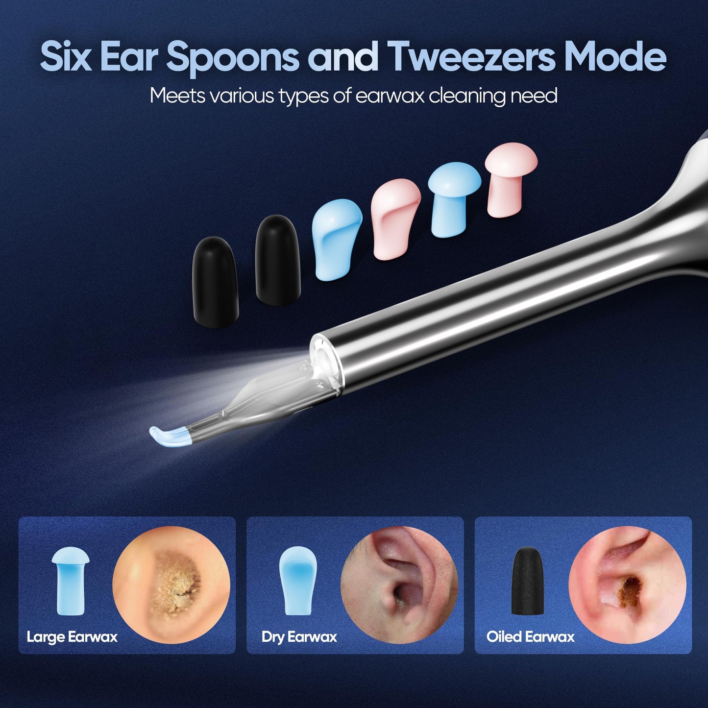 KWYBOW Note5 Ear Wax Tweezers with Camera, 10MP Ear Cleaner Camera Otoscope with Light,Real-time Remote Video with Ear Pick & Tweezers,12 Pcs Ear Scoops for Whole Family