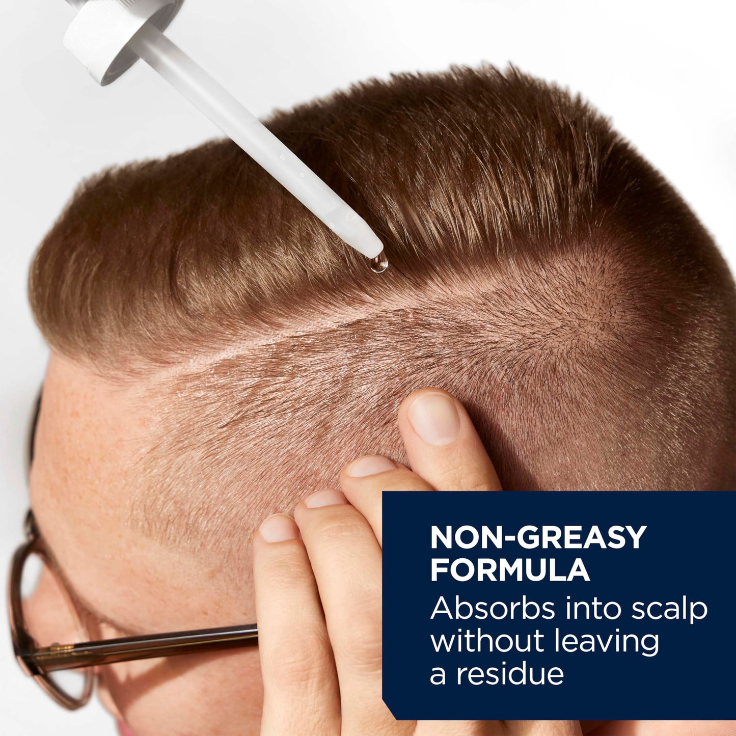 Head & Shoulders Scalp X 5% Minoxidil Hair Regrowth 2x Daily Leave-On Treatment for Men's Thinning Hair & Hair Loss, 3-Month Supply, 2 Fl Oz Each, (Set of 3)