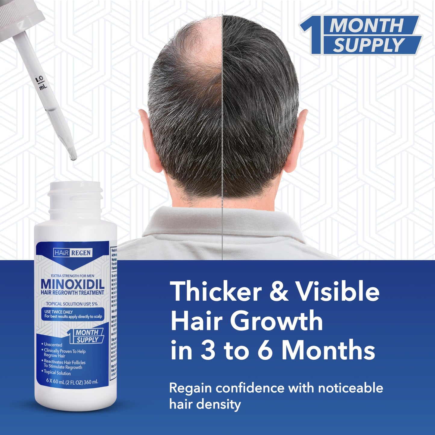 Hair Regen Liquid Minoxidil for Men 5% – Advanced Topical Solution for Regrowth – Growth Treatment for Men Hair Loss 6-Pack as 6-Month Supply Kit