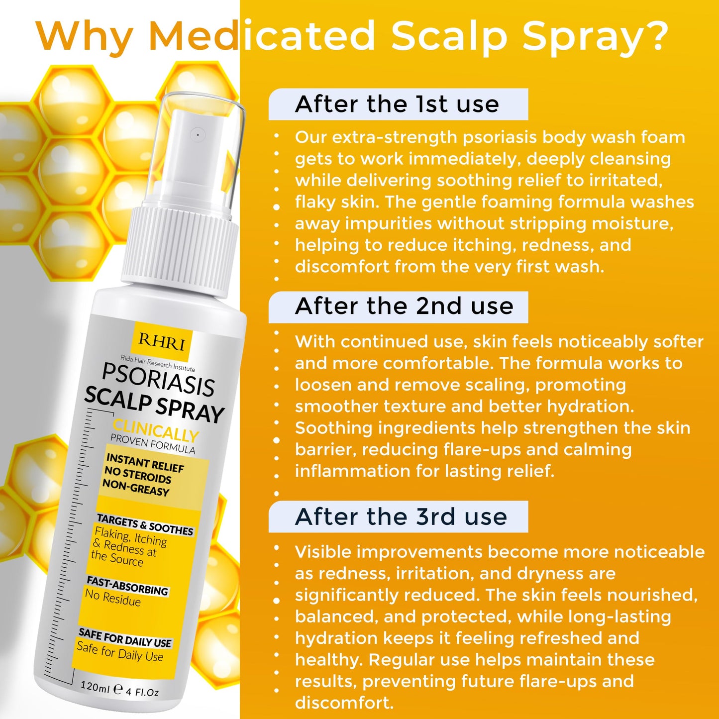 Psoriasis Scalp Spray | Psoriasis and Dandruff Treatment for Scalp Yeast Infections, Psoriasis Flare-Ups & Folliculitis | Antifungal Ringworm Itchy Scalp Spray for Dryness