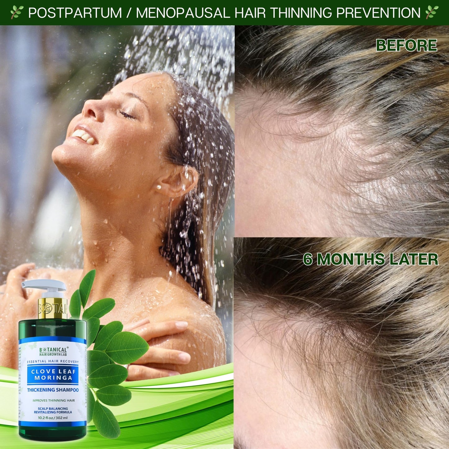 Botanical Hair Growth Shampoo for Hair Thickening Anti-Thinning Scalp Stimulating Natural Anti-Hair Loss Therapy For Women & Men 10.2 Fl Oz