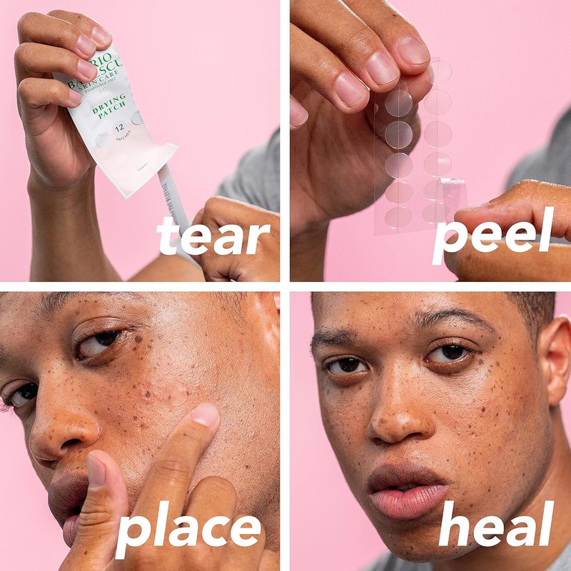 Mario Badescu Drying Patch - Invisible Spot Treatment with Vitamin C | 60 Patches, 12mm, Vegan & Cruelty-Free