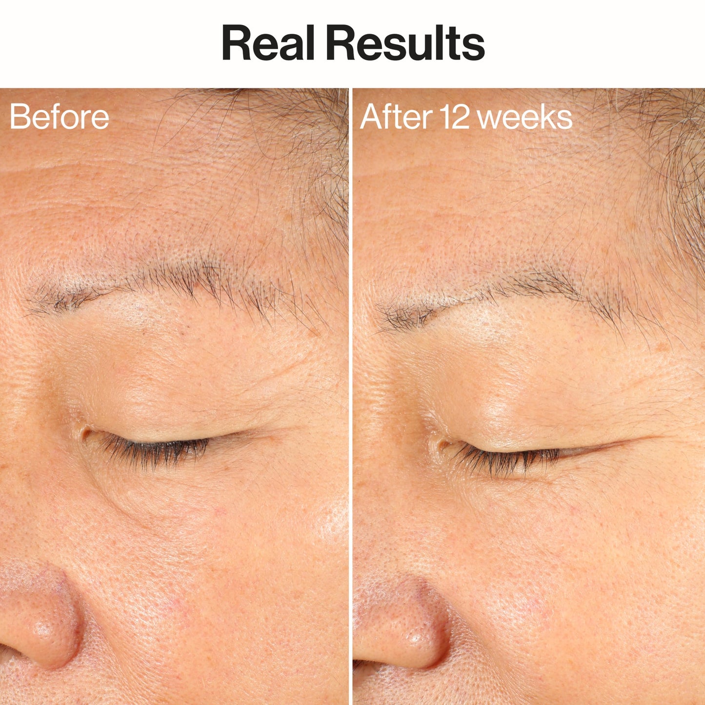 Honest Beauty Ageless Firm and Even Serum, Powered by Vegan Collagen Elastin Polypeptides, Firmer-Looking Skin, Fragrance Free, EWG Verified, Cruelty-Free, 1 fl oz