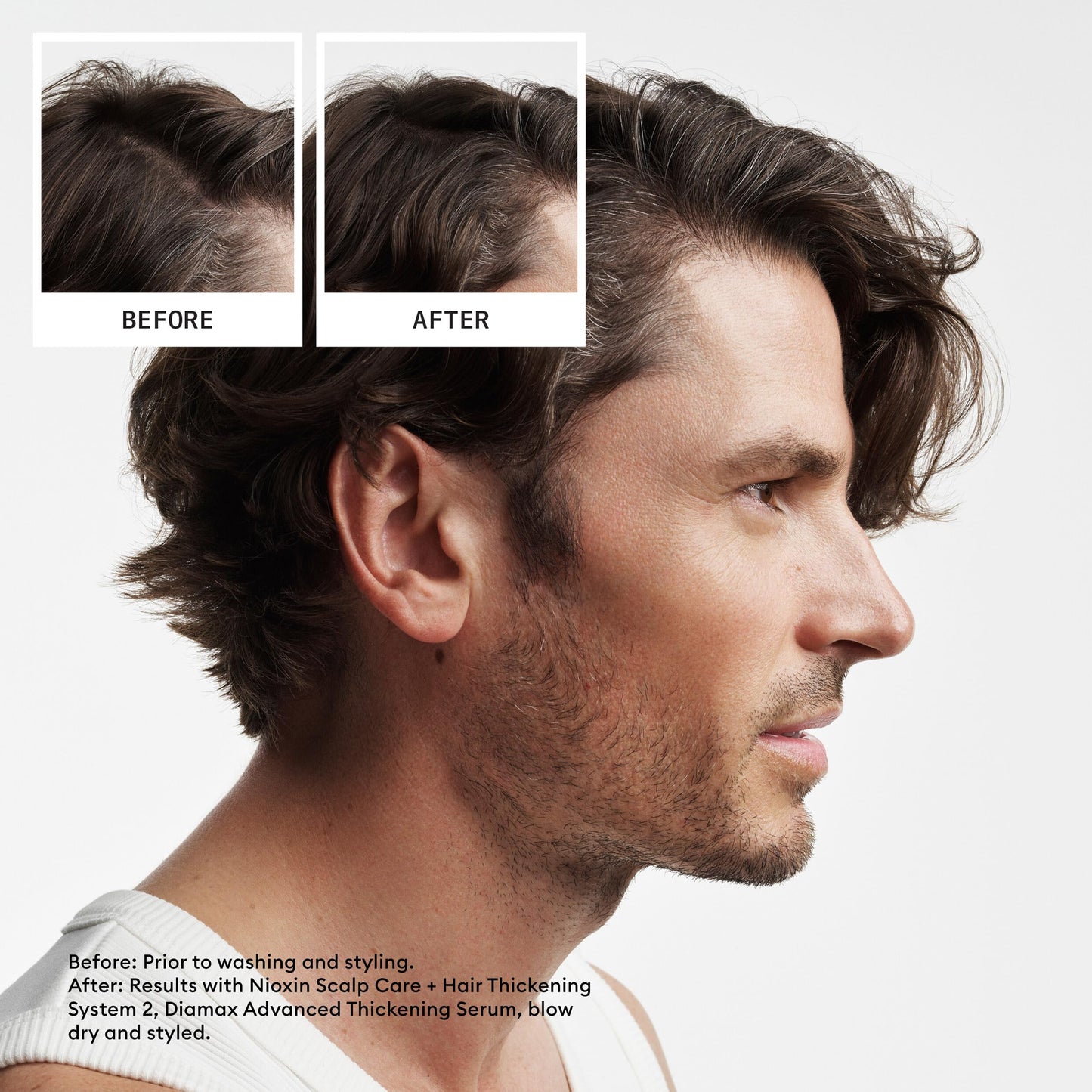 Nioxin Scalp + Hair Thickening System 2 Shampoo| For Natural or Untreated Hair with Progressed Thinning| With Niacinamide and Biotin| 33.8 Fl oz.