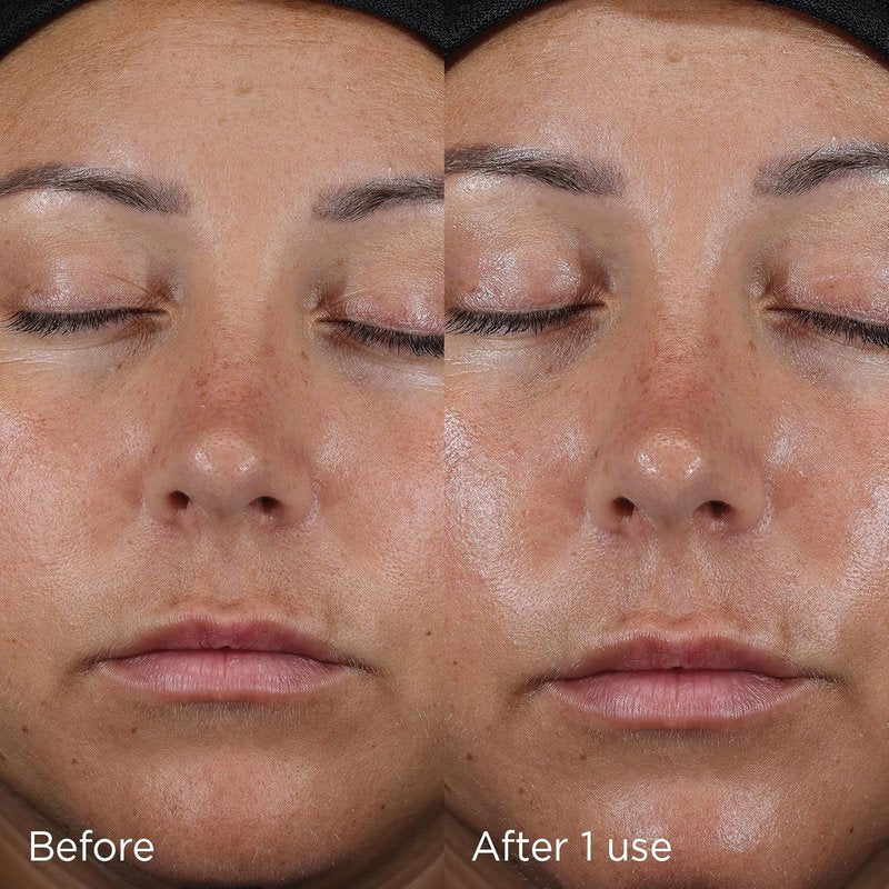 IMAGE Skincare Daily Prevention Moisturizer - SPF 50 Broad Spectrum Sunscreen, Fragrance-Free