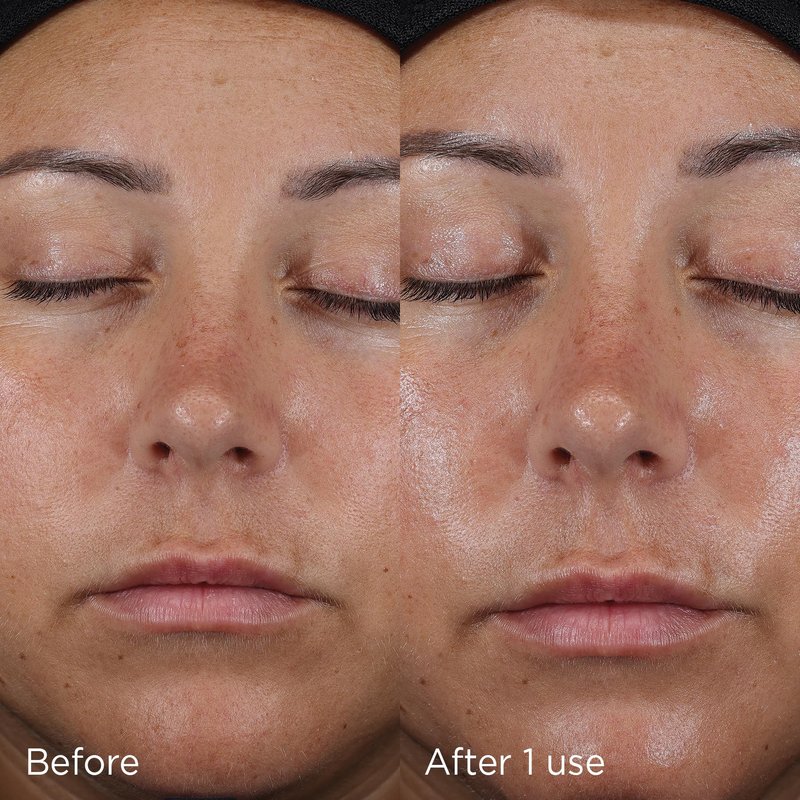 IMAGE Skincare DAILY PREVENTION Ultra Defense Moisturizer, SPF 50 Broad Spectrum Sunscreen, Fragrance Free, 1 Ounce Travel Size