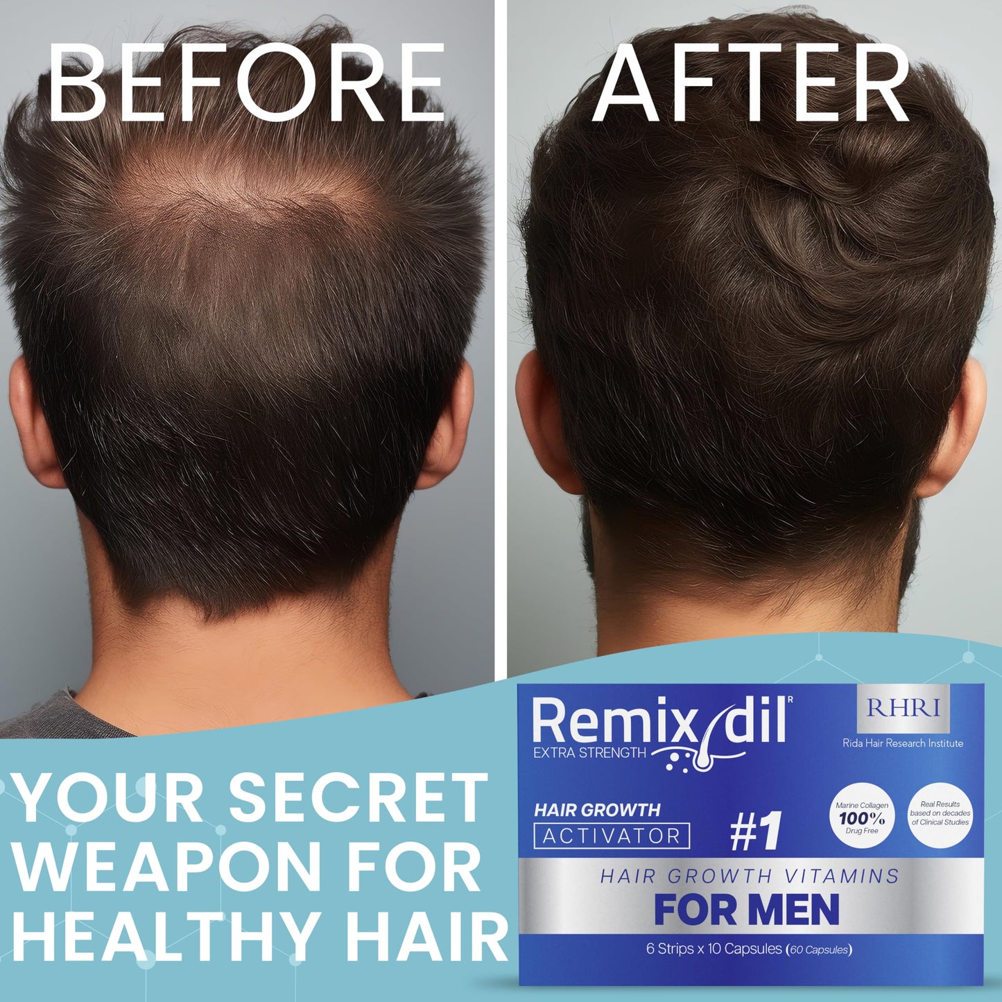 Hair Growth Vitamins Hair Regrowth For Men | Supports Beard And Scalp Strength | Helps Reduce Thinning And Breakage | Fast-Acting Formula To Boost Volume | 60 Capsules