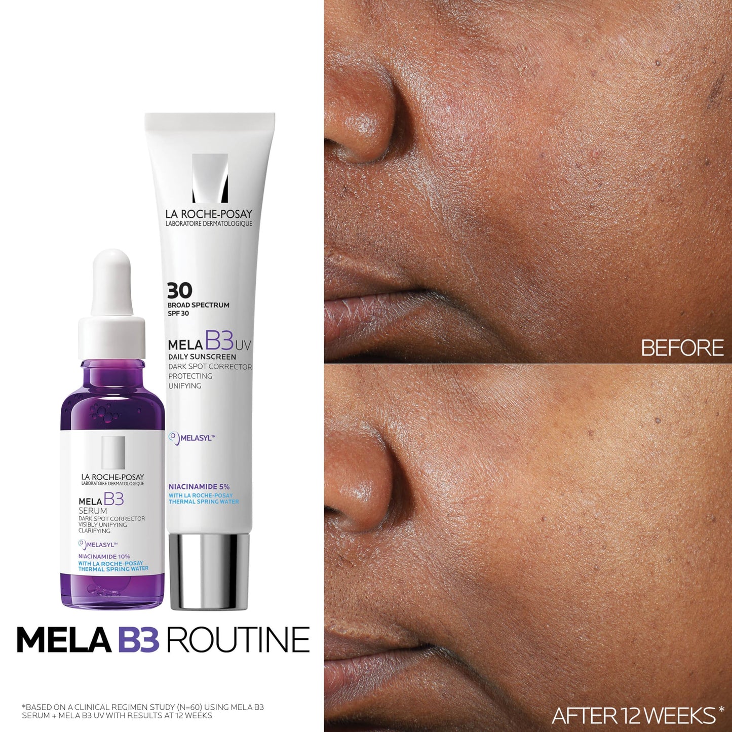 Bundle of La Roche-Posay Mela B3 Serum, Dark Spot Corrector With Melasyl + 10% Niacinamide + Mela B3 Gel Cleanser, Anti Aging Face Wash + Mela B3 UV Daily Sunscreen, Face Moisturizer With SPF 30
