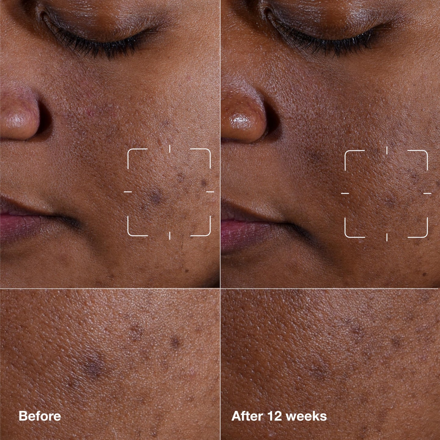 Clinique Even Better Clinical Dark Spot Clearing Vitamin C Face Serum For All Skin Types | Brightening + Soothing