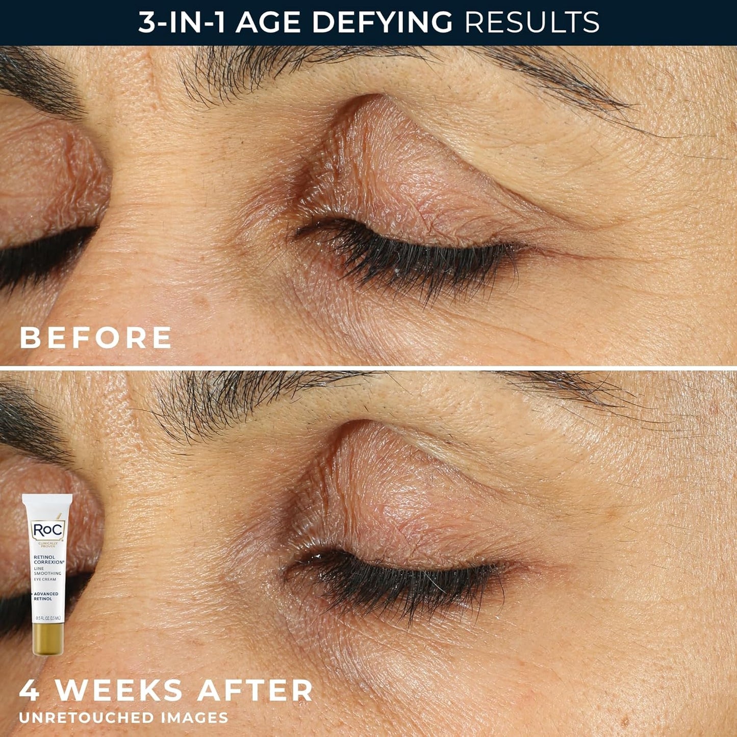 RoC Retinol Correxion Duo Set | Deep Wrinkle Night Cream & Under Eye Treatment for Dark Circles