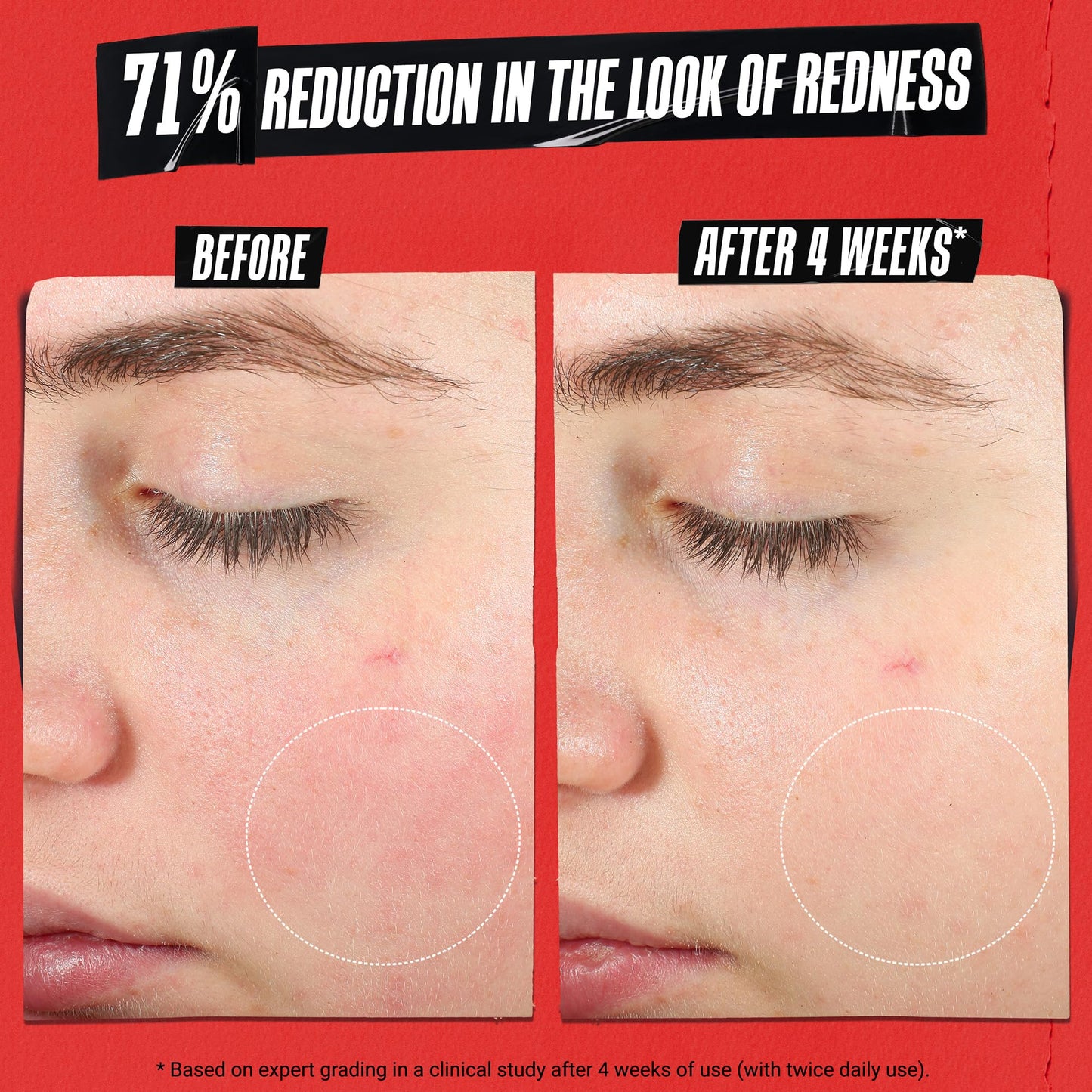 Kiehl's Ultra Facial Recovery Barrier Cream, Lightweight Moisturizing Face Cream, Provides Moisture Boost, Lotion Repairs and Restores Skin Barrier, Suitable for Dry and Sensitive Skin