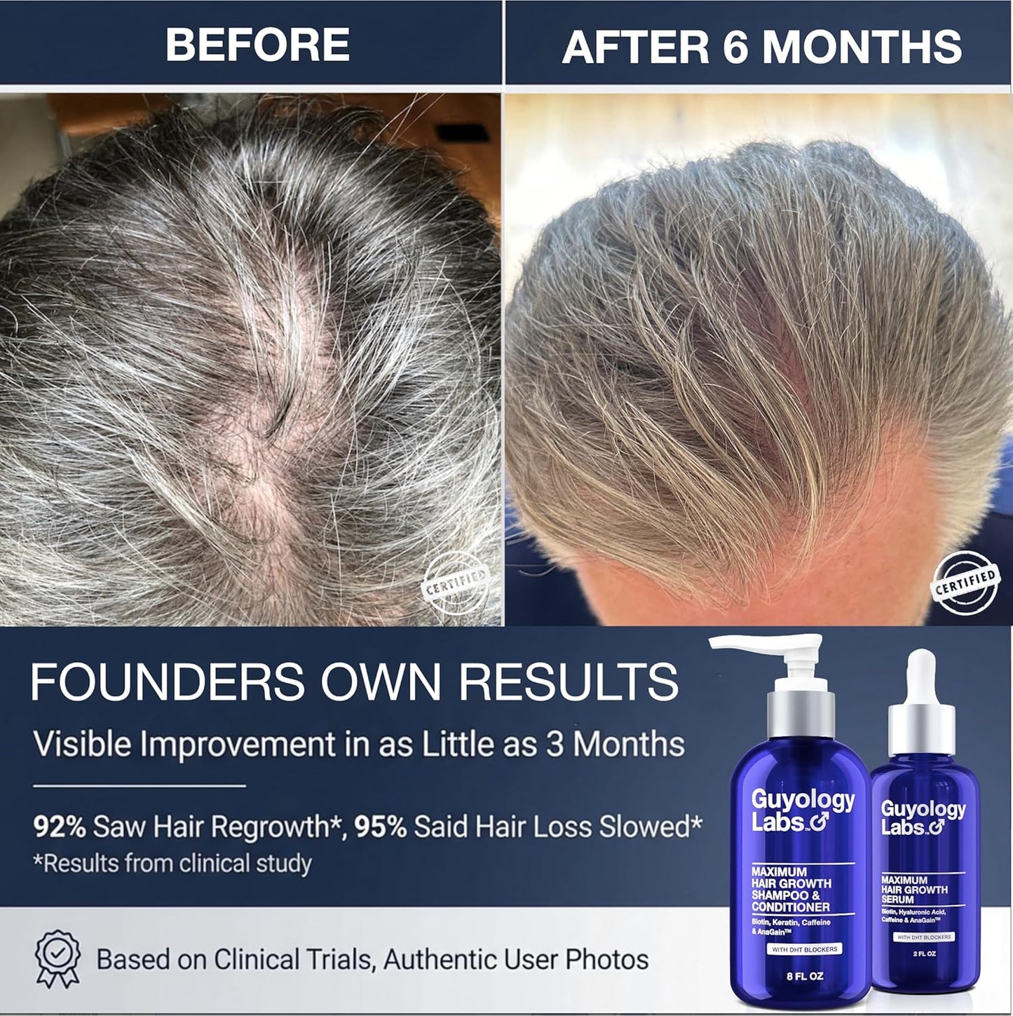 Hair Growth Shampoo & Conditioner - DHT Blocker for Thinning Hair | 2% AnaGain™, Biotin & Caffeine | Unisex Formula