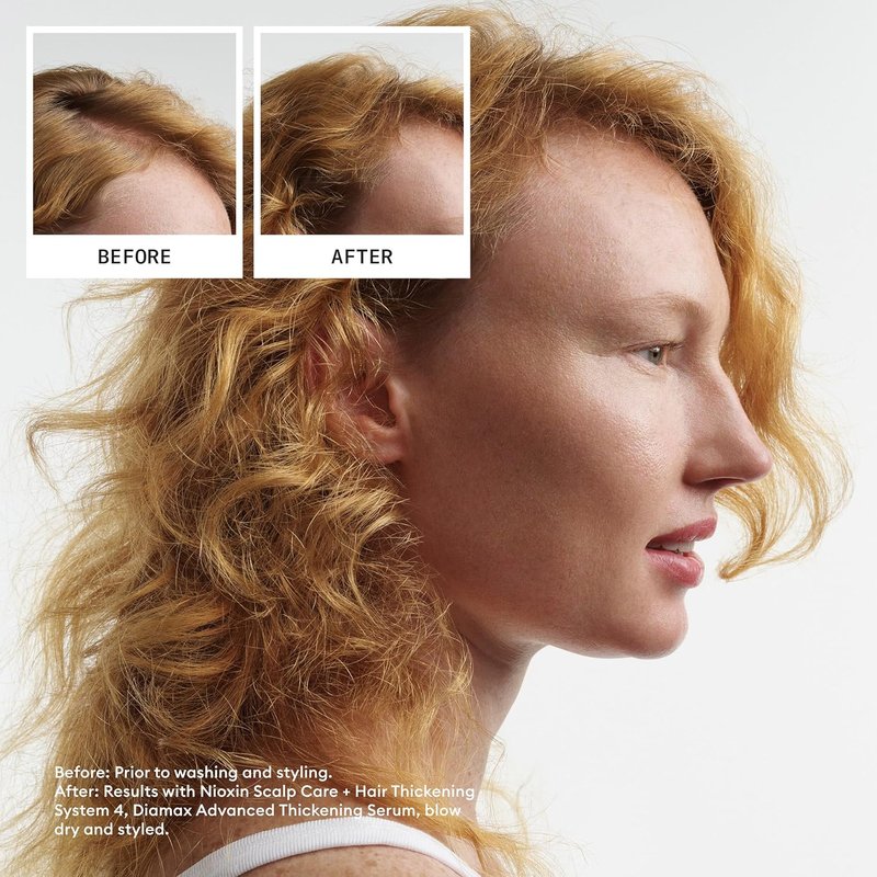 Nioxin System 4 Conditioner - Scalp & Hair Thickening for Colored, Dry, Damaged Hair | Nourishes & Boosts Density with Niacinamide & Biotin