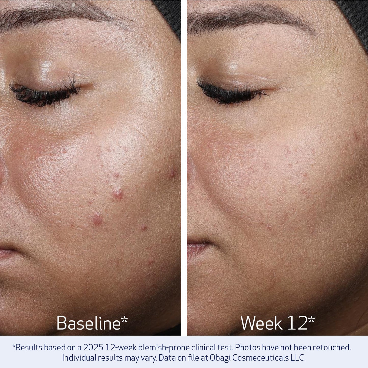 Obagi NU-GEN NAD+ Cellular Renewal Face Serum with Niacinamide & NMN – 1 oz