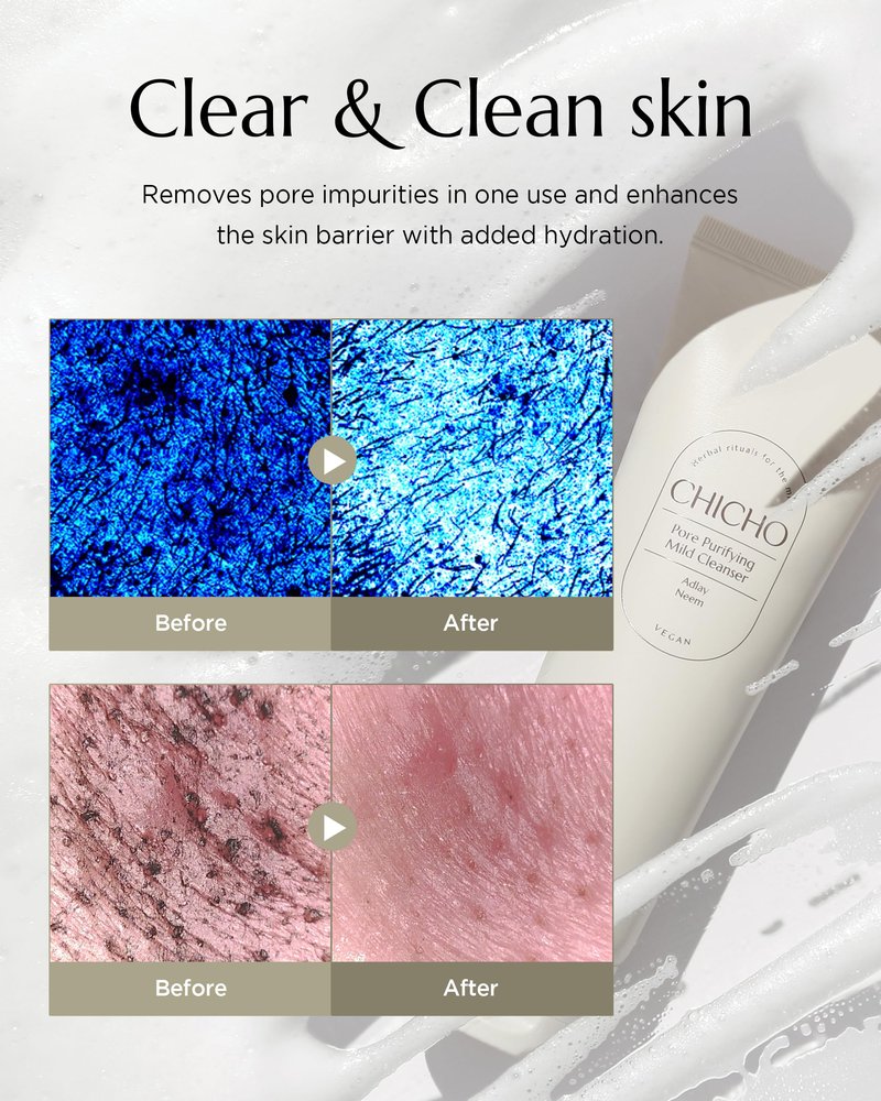 CHICHO Korean Pore Cleanser - Daily Micro-Polish Scrub Foam with Job's Tears 10,000ppm & PHA, 5-Ceramide Barrier, Non-Stripping Gentle Face Wash for Sensitive Skin, 4.05 fl oz