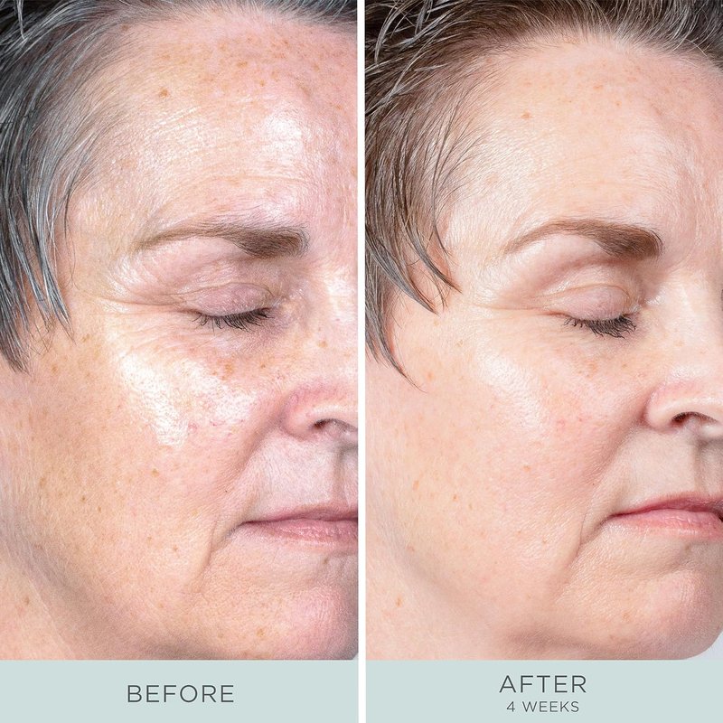Ceretin Boost Retinol Serum - Age Defying Skincare Treatment | 1 oz