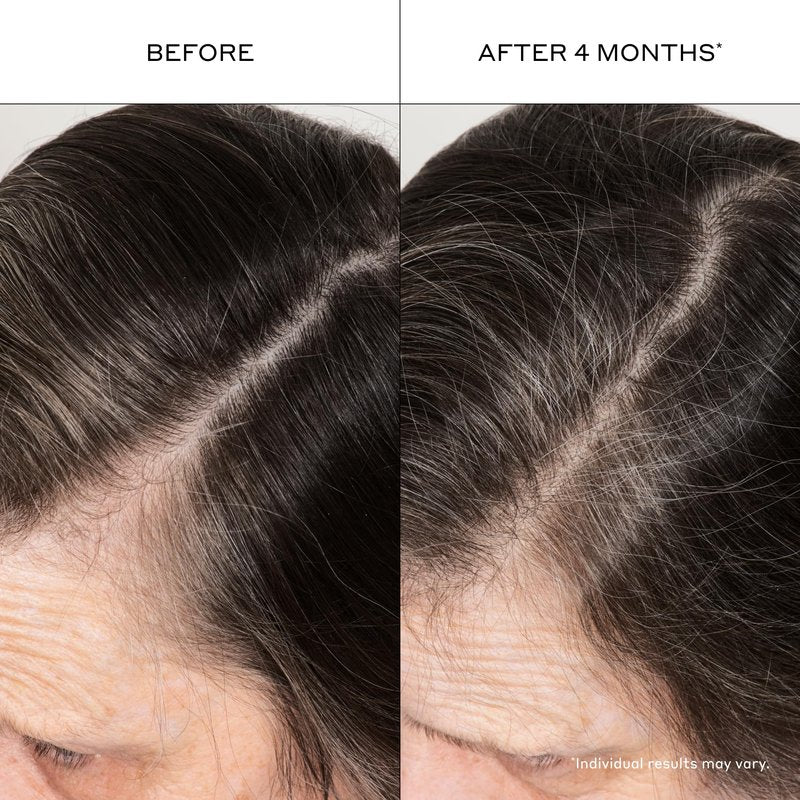 ZENAGEN Densifying Hair Serum for Fine + Thinning Hair | Boosts Hair Density, Strengthens & Nourishes Hair Follicles, Non-Greasy Water-Based Formula, Plant-Based, Vegan, All Hair Types, 1 oz