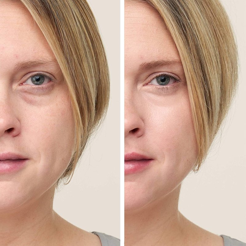 Jane Iredale CircleDelete Concealer - Creamy Under Eye Concealer with Vitamins A, C & E | Reduces Dark Circles & Fine Lines