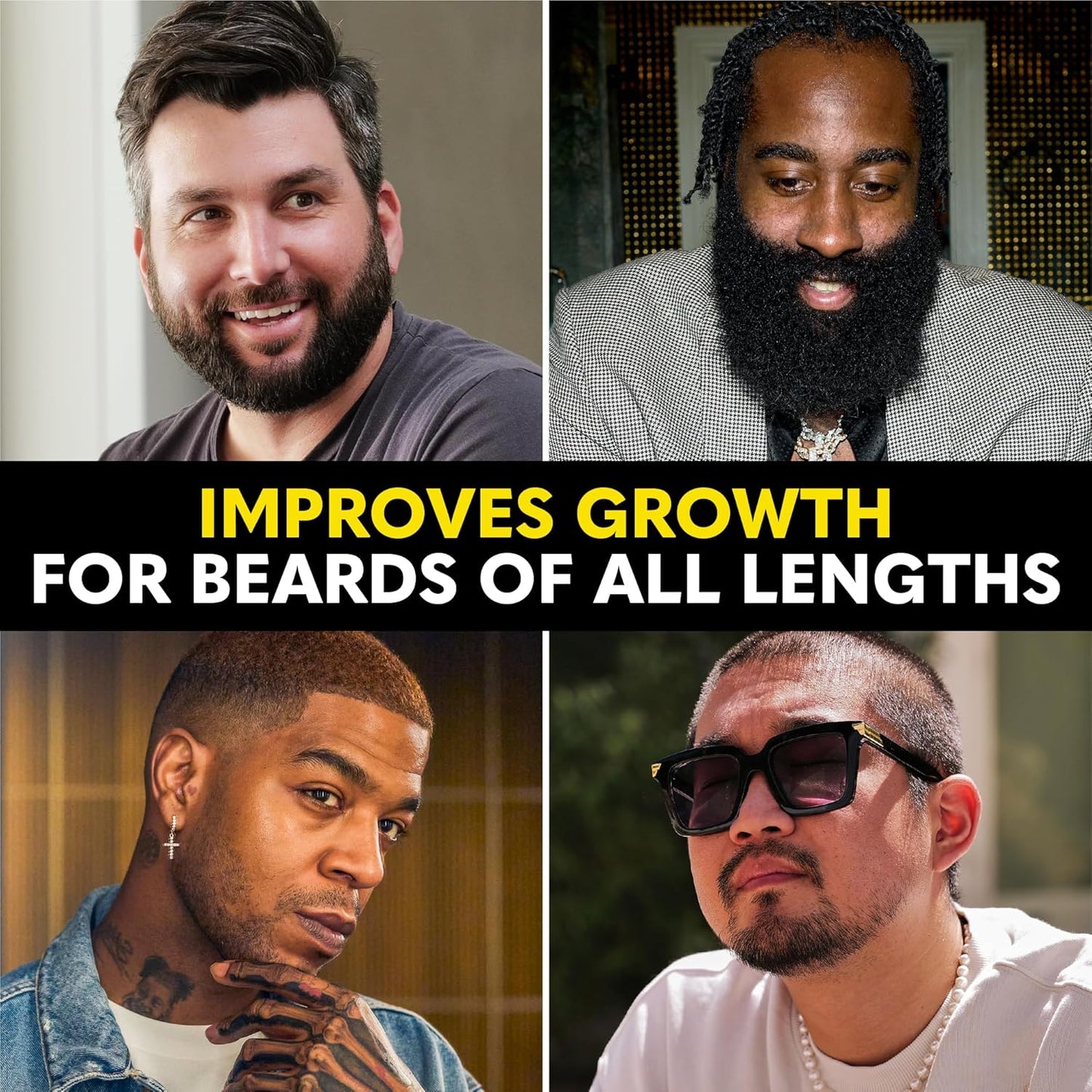 Beard Growth Serum - Natural Castor, Coconut & Avocado Oil for Thicker, Fuller Beards | Stimulates Healthy Hair Growth