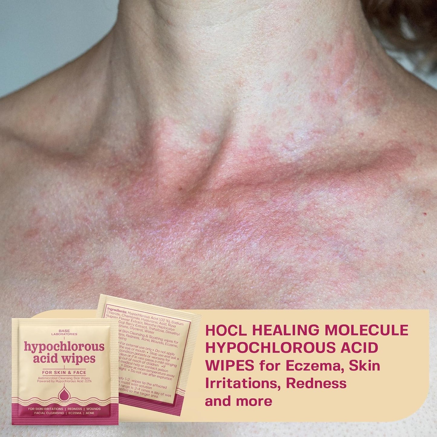 Hypochlorous Acid Wipes for Face & Skin | Daily Cleansing & Repair for Sensitive Skin - 75 Wipes