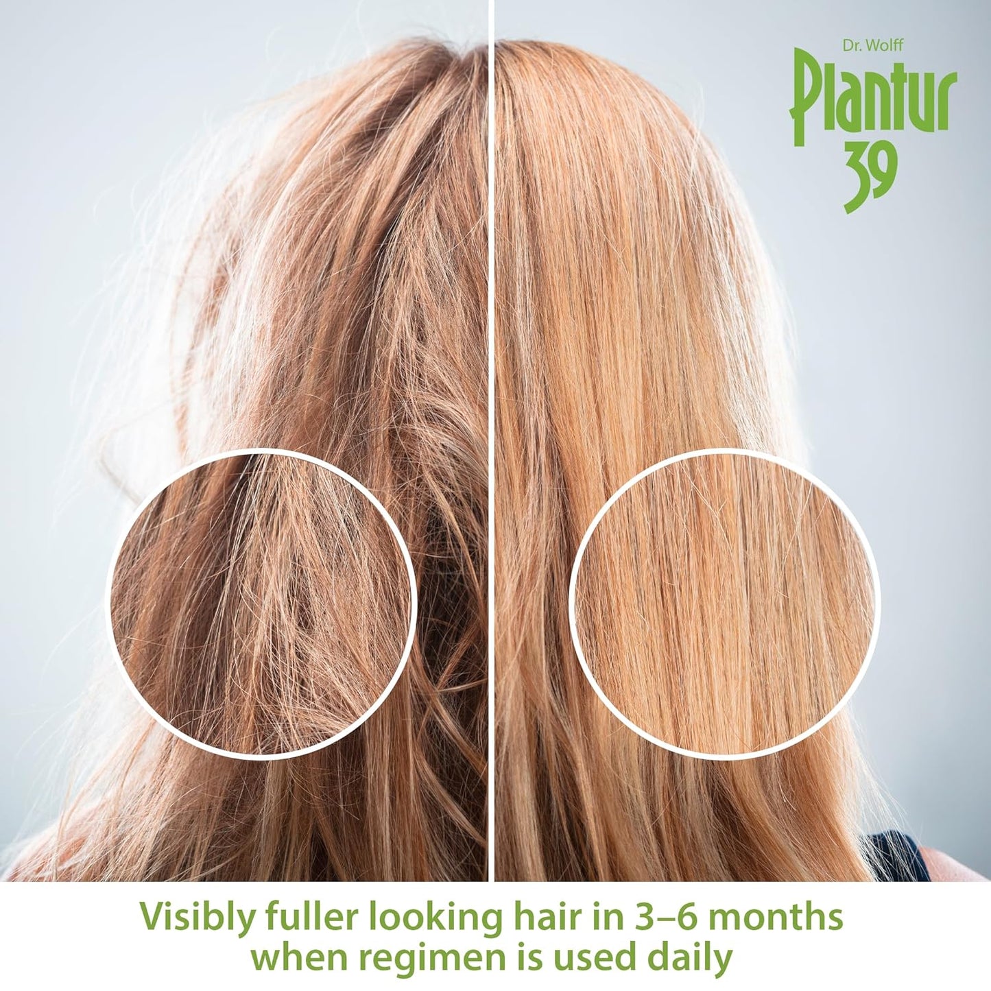 Plantur 39 Fine & Brittle Hair Shampoo - Phyto-Caffeine Formula for Women's Thinning Hair | 16.9 fl oz