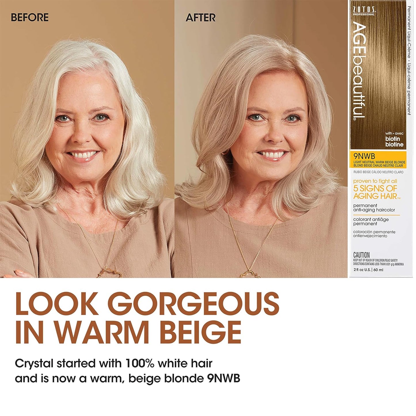 AGE Beautiful Permanent Hair Color Cream - 100% Gray Coverage Hair Dye with Biotin for Thicker, Fuller Hair | Professional Salon Quality