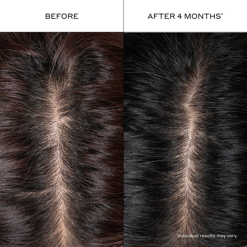 ZENAGEN Densifying Hair Serum for Fine + Thinning Hair | Boosts Hair Density, Strengthens & Nourishes Hair Follicles, Non-Greasy Water-Based Formula, Plant-Based, Vegan, All Hair Types, 1 oz