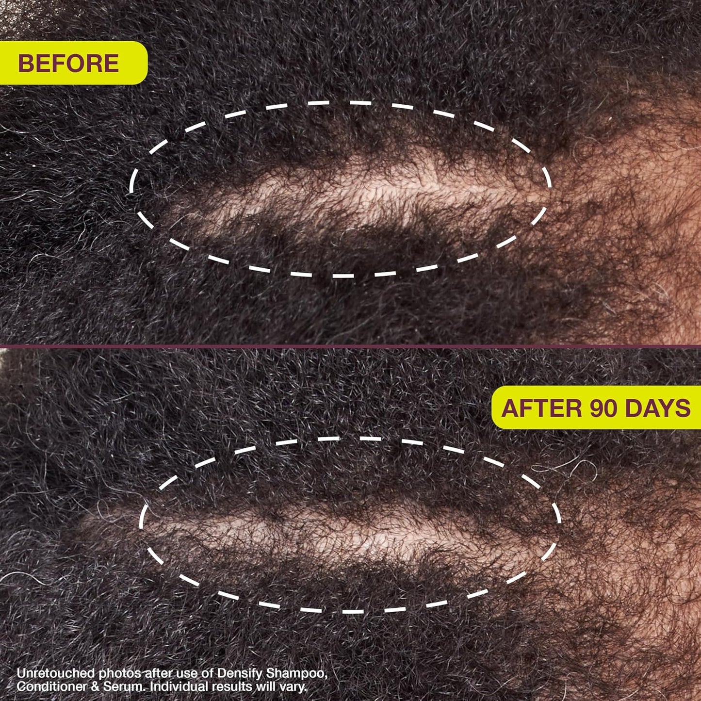 Densifying & Thickening Serum for Thinning Hair - 1oz | Nourishing Hair Growth Formula