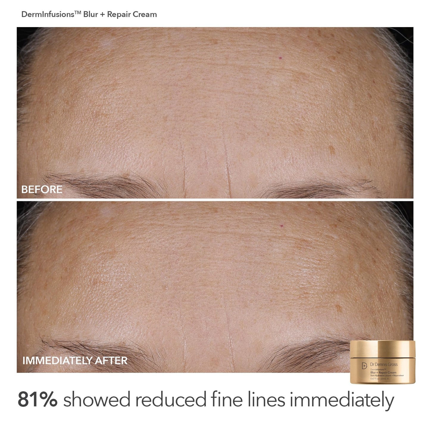 Dr Dennis Gross Plump & Smooth Limited Edition Kit – DermInfusions™ Blur + Repair Cream (0.67 oz) + 5 Alpha Beta® Universal Daily Peels | $50 Value