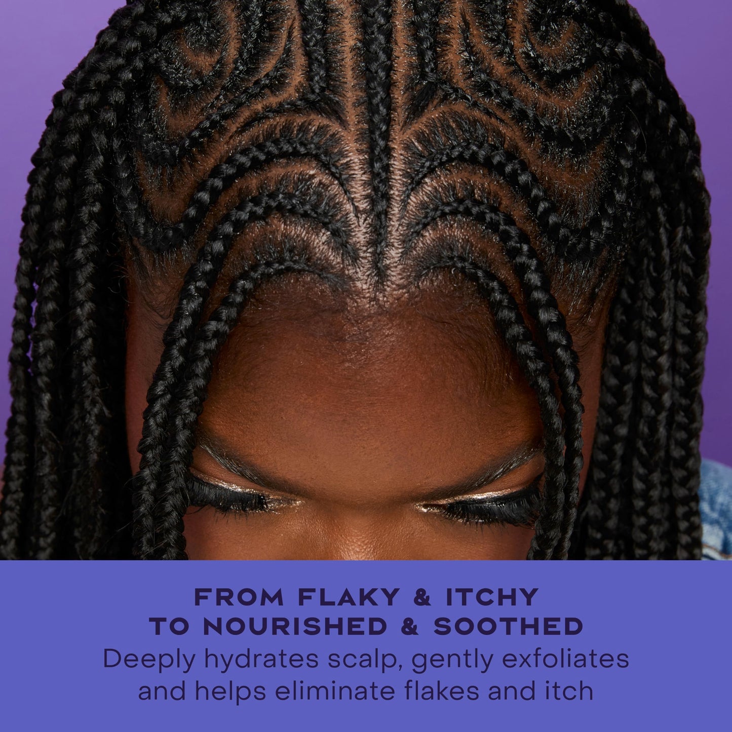 SheaMoisture Dandruff Treatment Scalp Repair Technology & Hydrate Serum with Salicylic Acid, Deeply Hydrates to Reduce Flakes & Itch, 2 fl oz