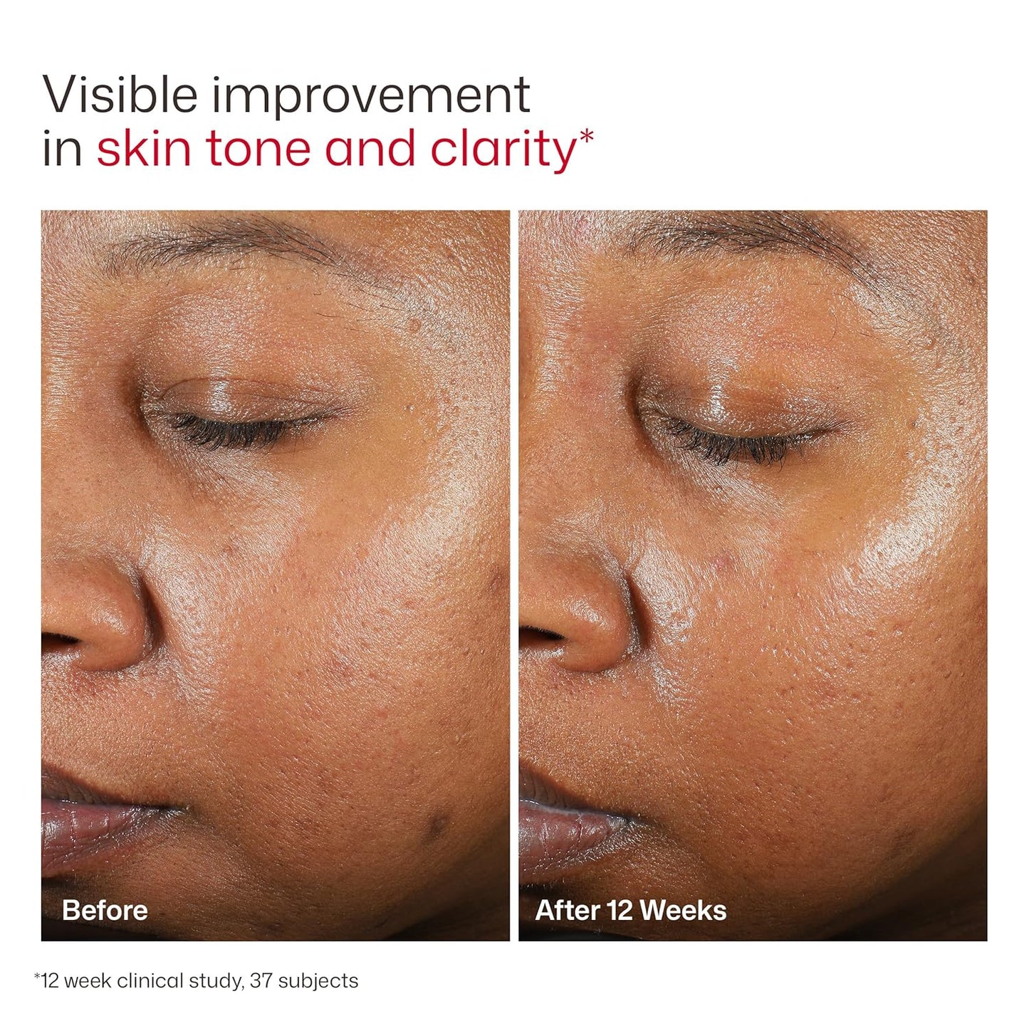 EltaMD UV Clear Face Sunscreen SPF 46 - Oil-Free Zinc Oxide Formula | 0.5 oz